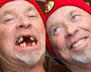 Dental before & after